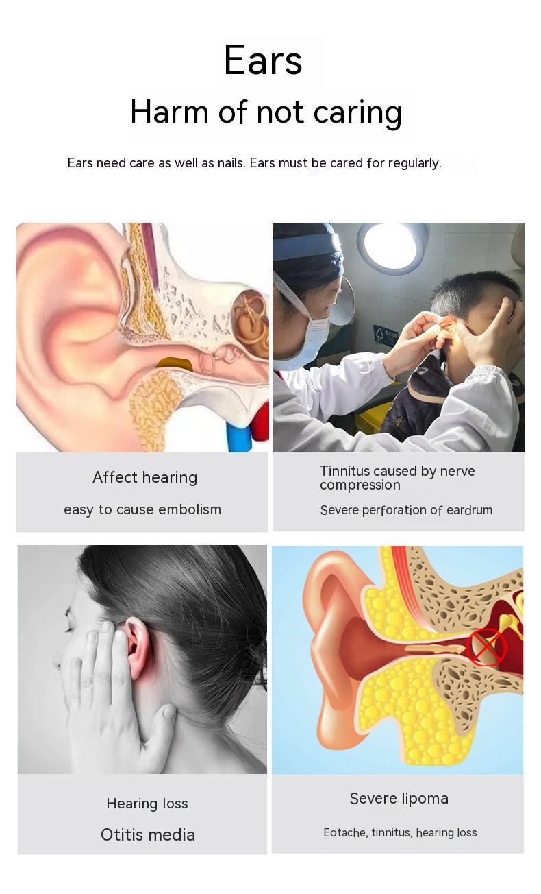 Wireless Visual Ear Cleaner – HD Endoscope with LED Light & Camera
